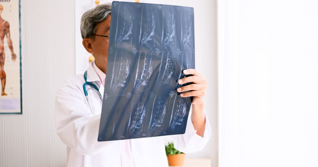 DEXA Scan Near Me and Retesting Frequency